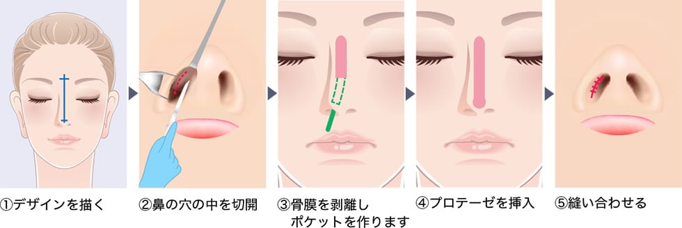 治療の流れ