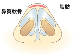 軟骨