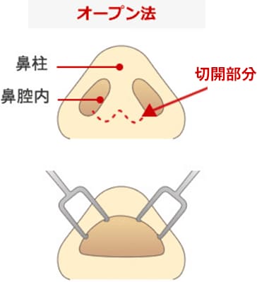 オープン法