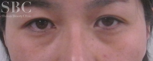 症例写真