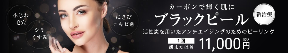ブラックピール