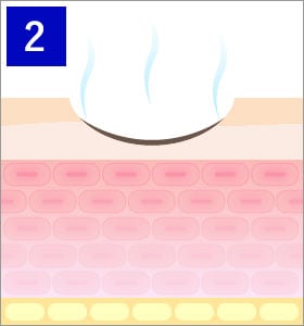 炭酸ガスレーザーのメカニズム2