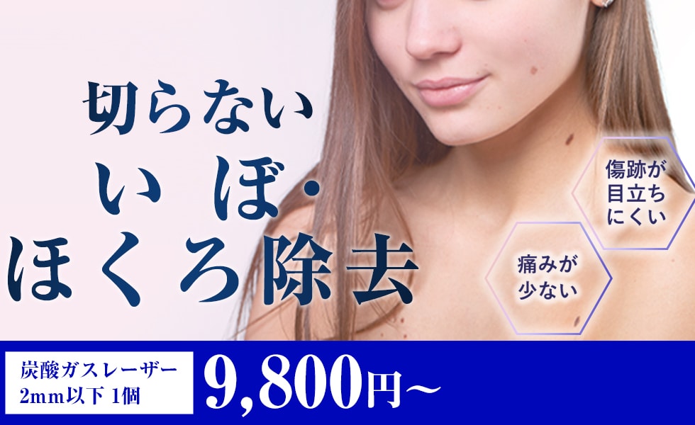湘南美容クリニックの切らないいぼ・ほくろ除去