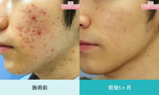 症例10