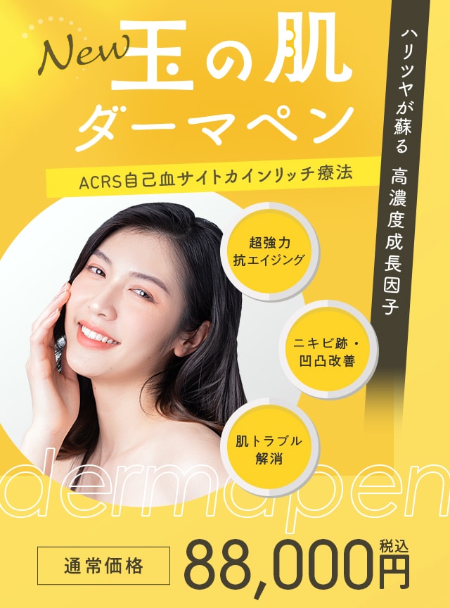 玉の肌ダーマペン(ACRS自己血サイトカインリッチ療法)