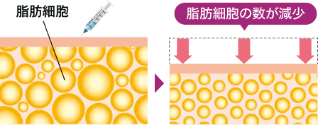 脂肪細胞が減少