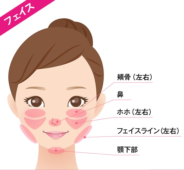 脂肪溶解注射 BNLS アルティメット（小顔注射）の対応部位 フェイス