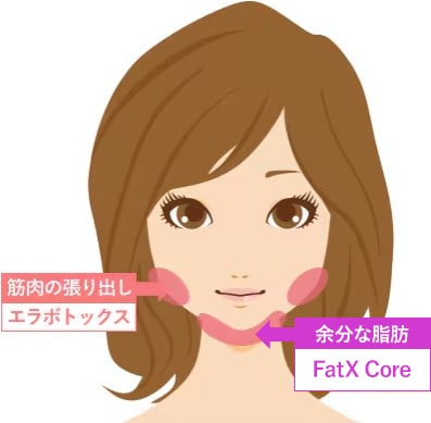 FatX Coreとエラボトックス