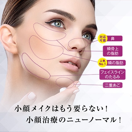 BNLS アルティメット 画像