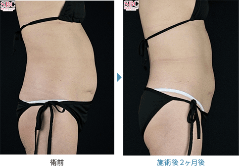 症例写真4
