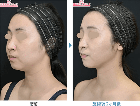 症例写真6