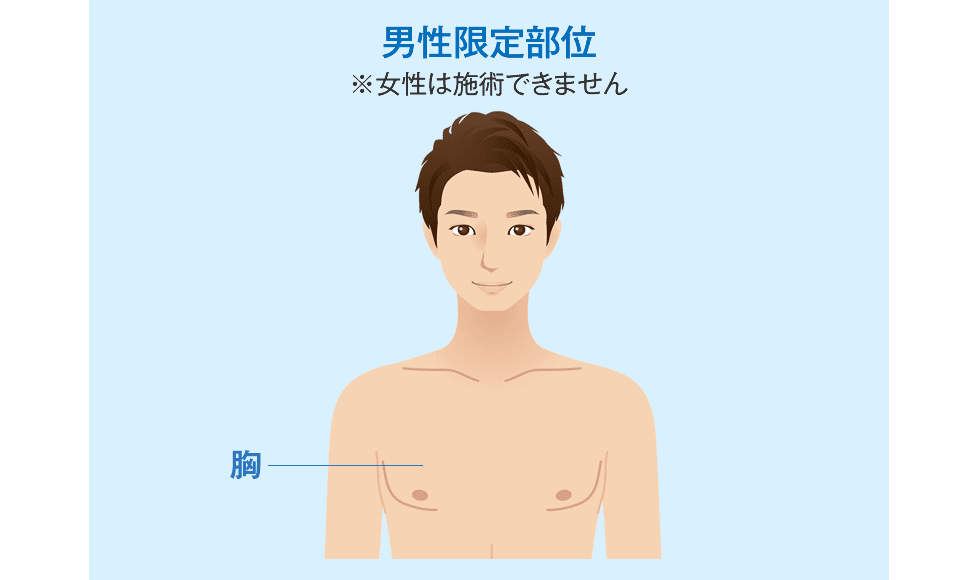 男性限定のクールスカルプティング&reg; エリート（クルスカダブル）施術対象部位