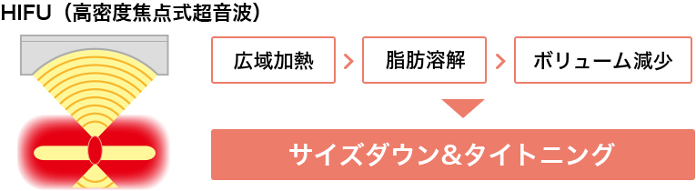 高密度商店式超音波の仕組み