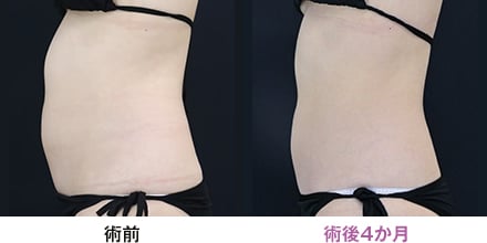 症例写真 画像02