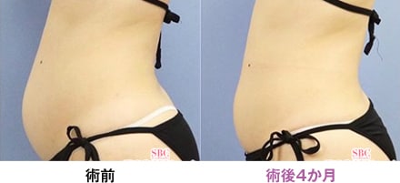 症例写真 画像03