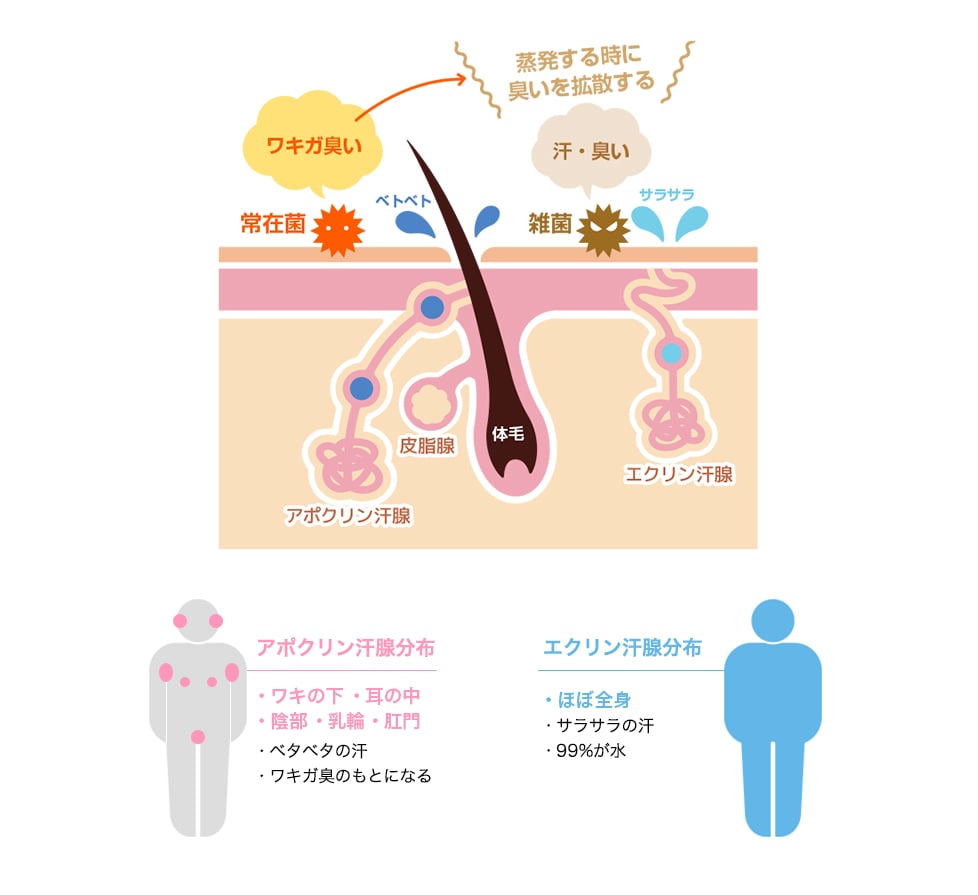 多汗症について