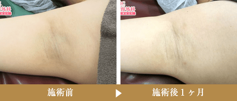 症例写真150031