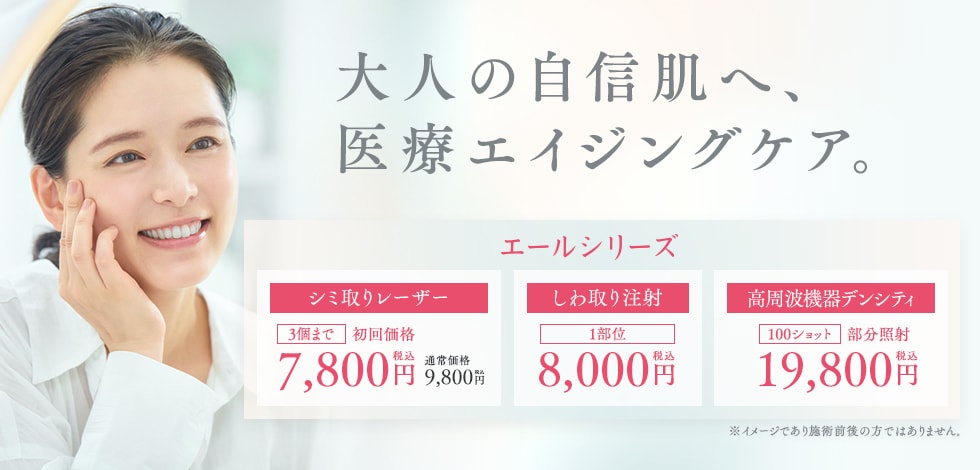 YELL