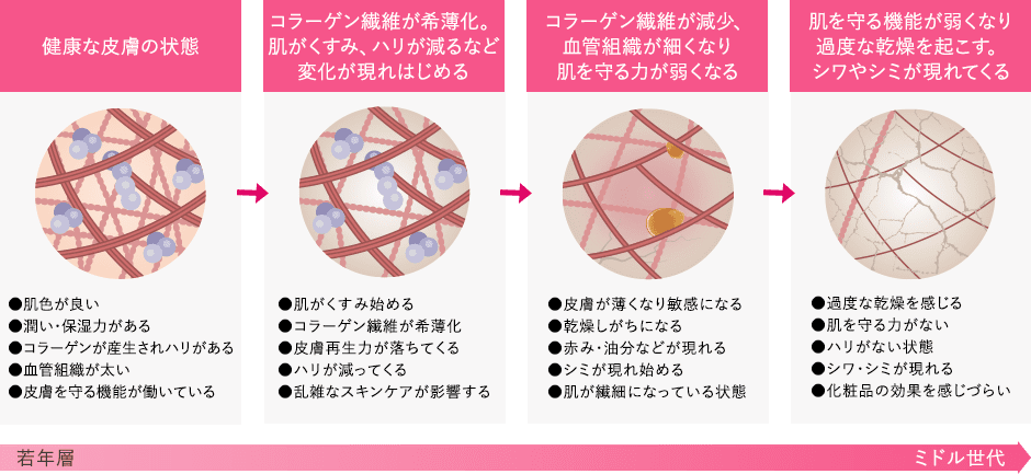 シミ・しわの原因