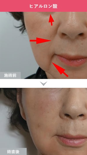 症例写真1