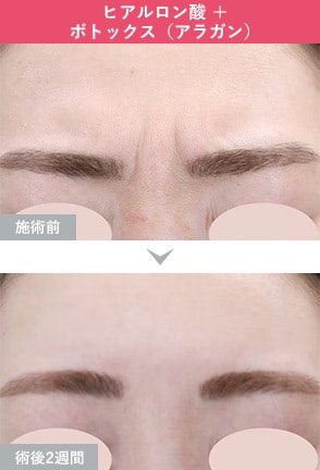 症例写真1