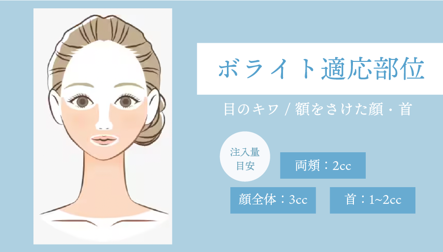 ボライトXCの適応部位と推奨注入量／他メニューとの施術