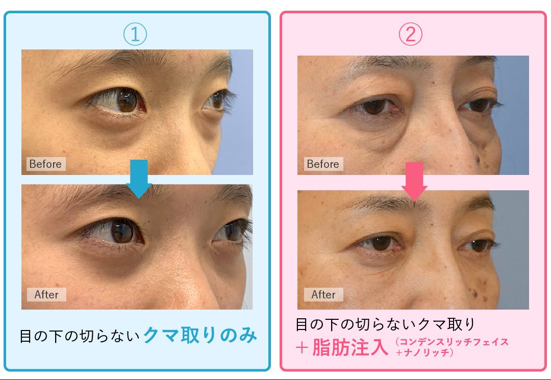 年齢だけじゃない！2つの症例写真の違い