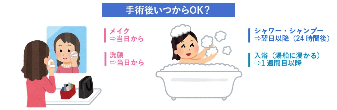 糸リフト施術後、お風呂はいつから入れる？