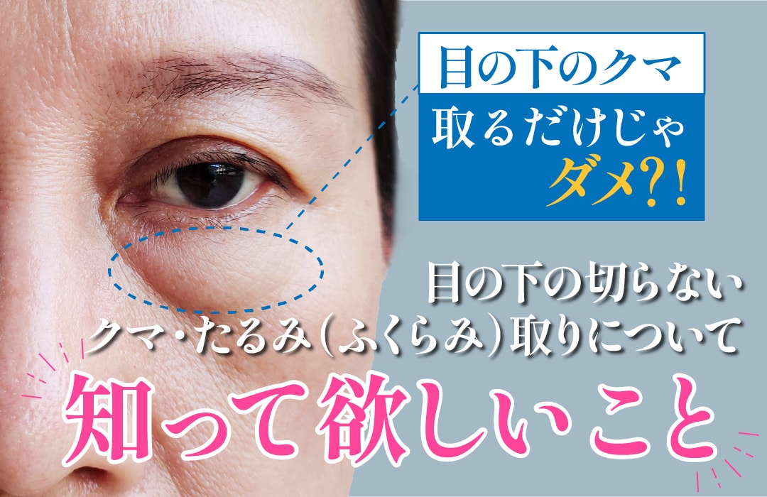 目の下の切らないクマ・たるみ（ふくらみ）取りについて知っておいて欲しいこと