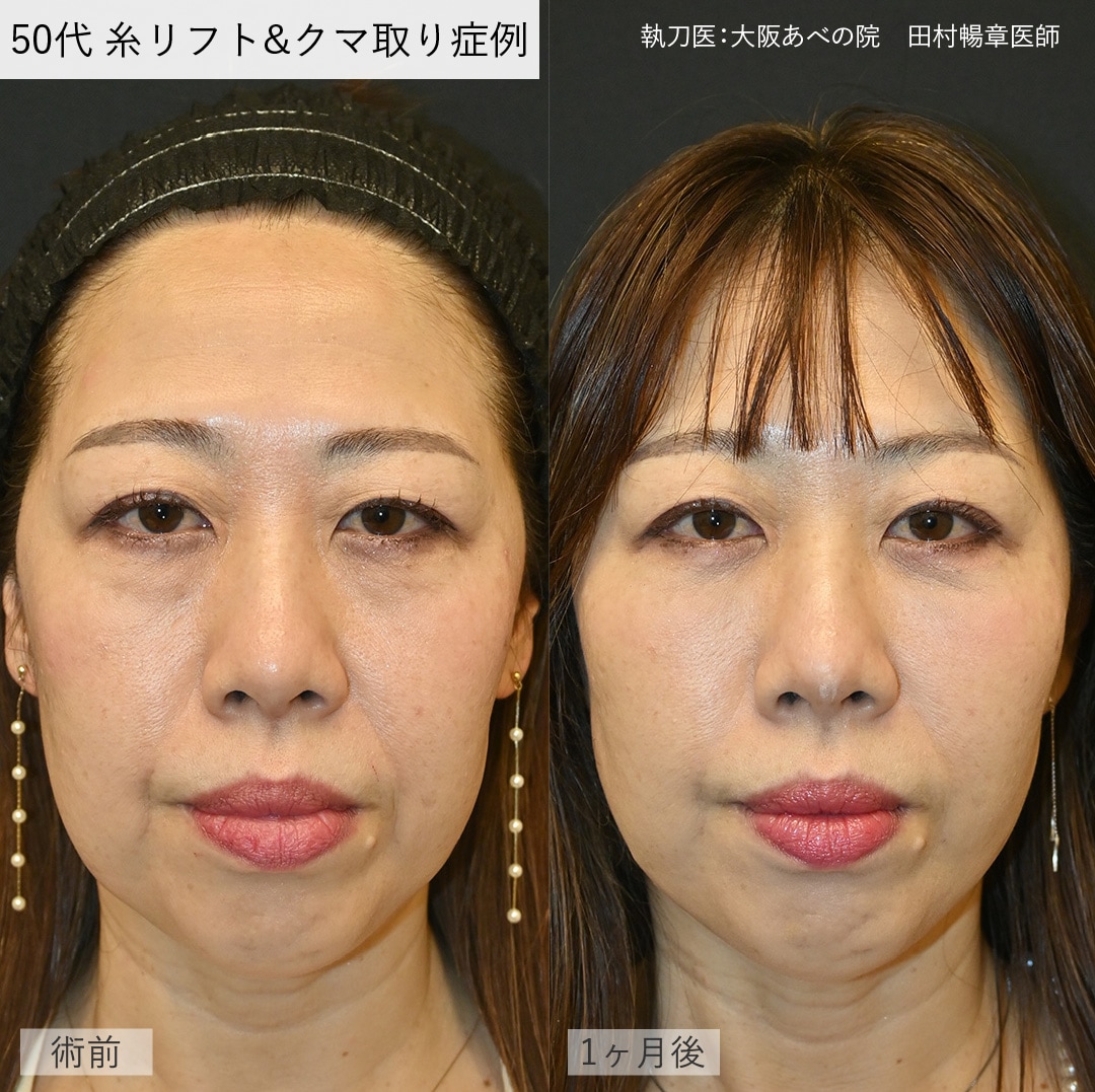 ビフォーアフター