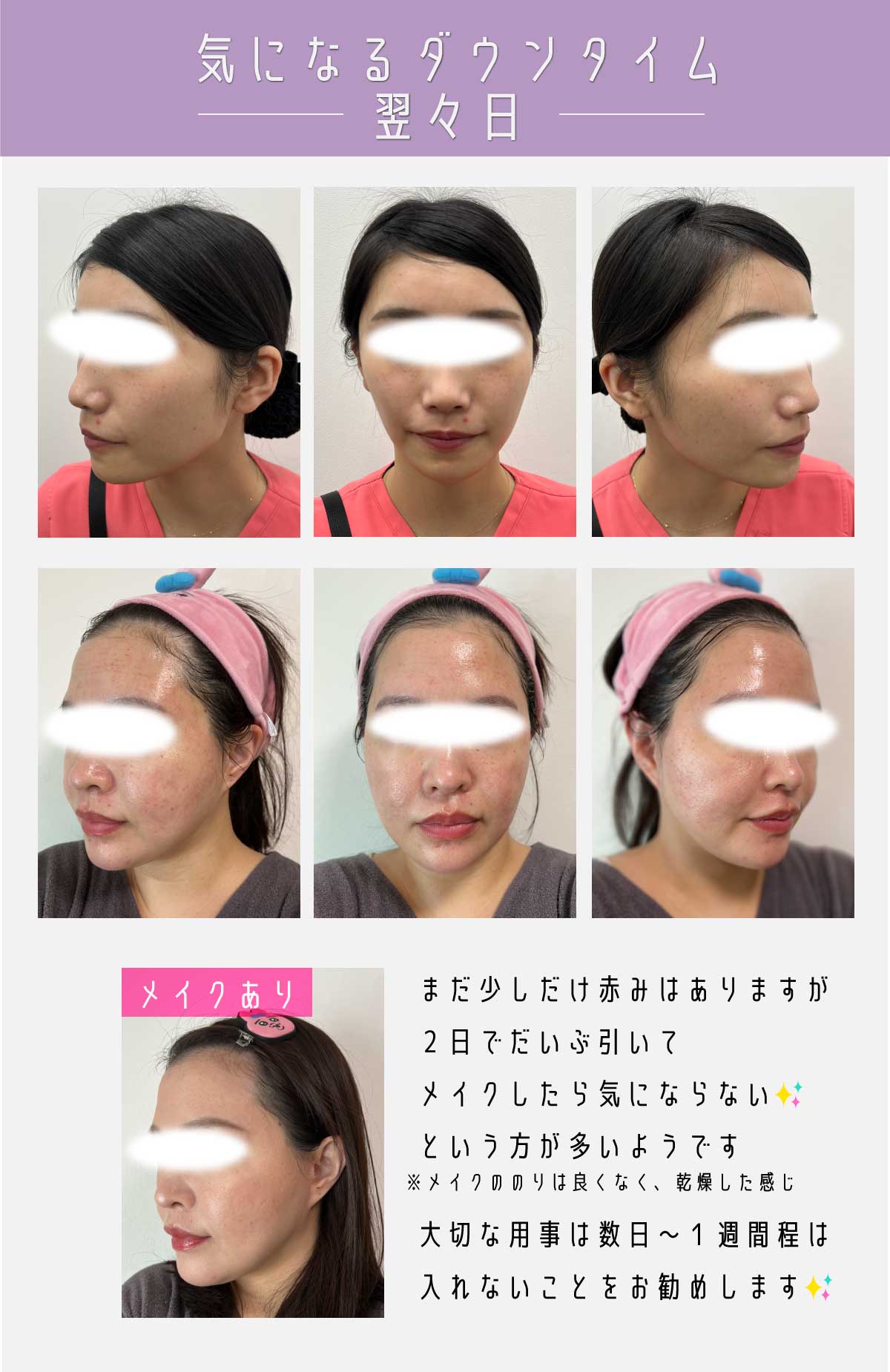 大公開！症例写真《翌々日》
