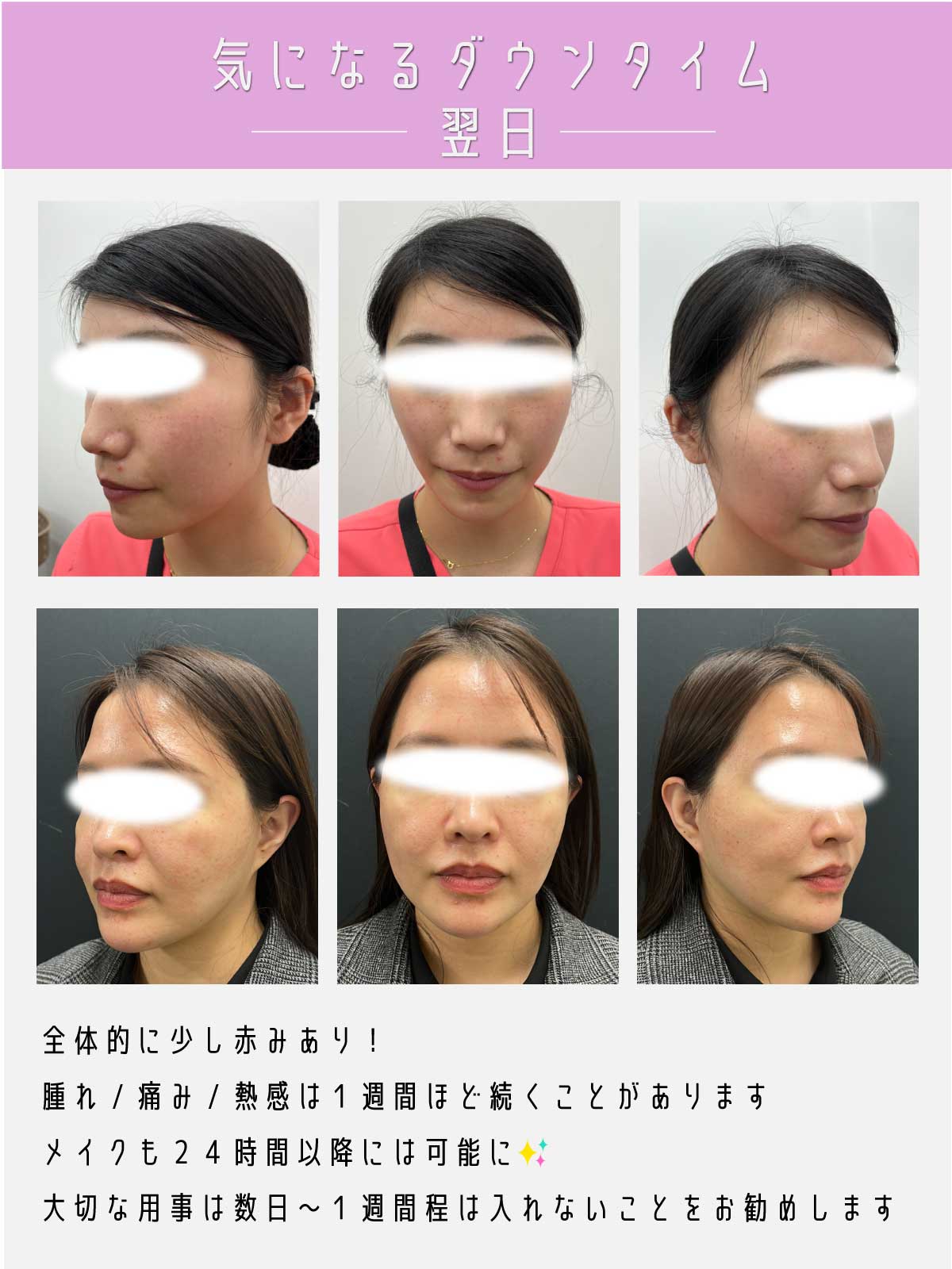 大公開！症例写真《翌日》