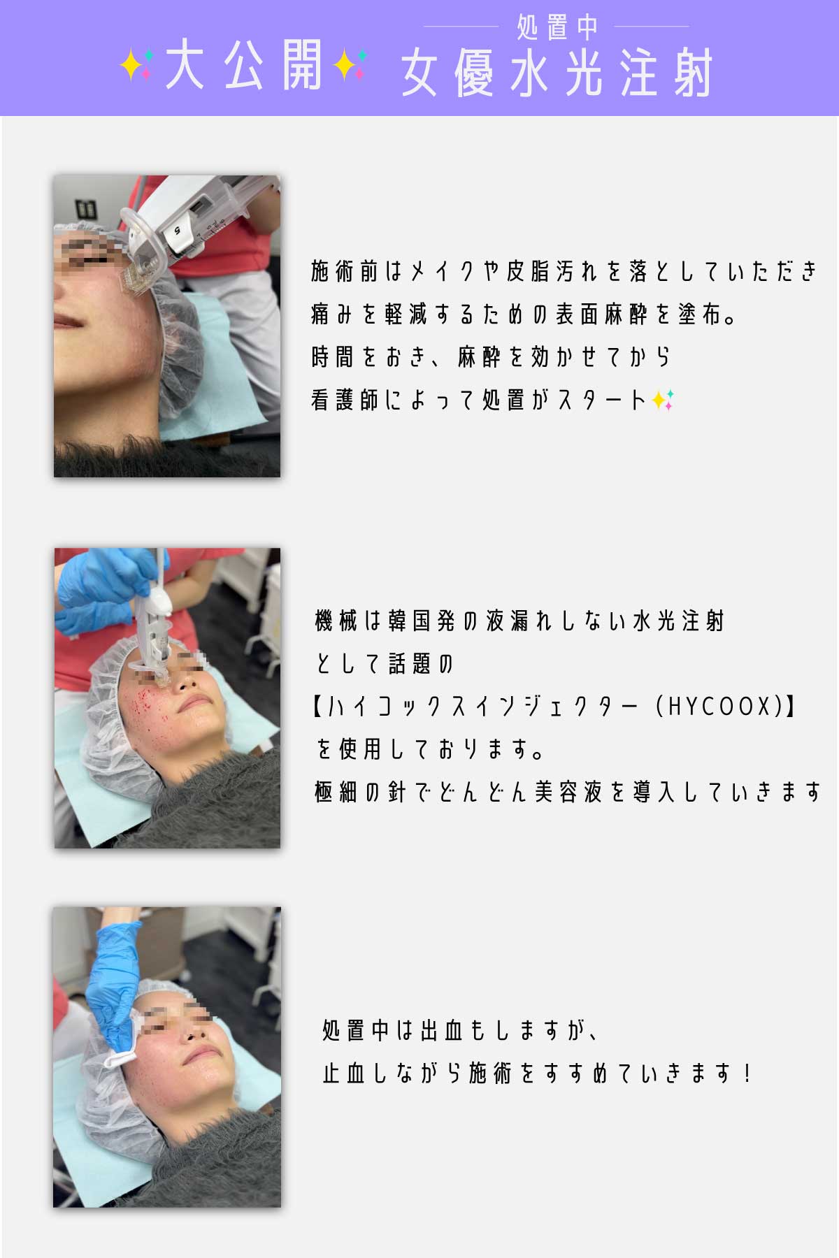 女優水光注射はこのように行われています✨☝️
