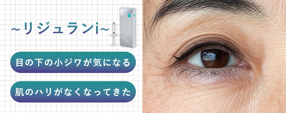リジュランi