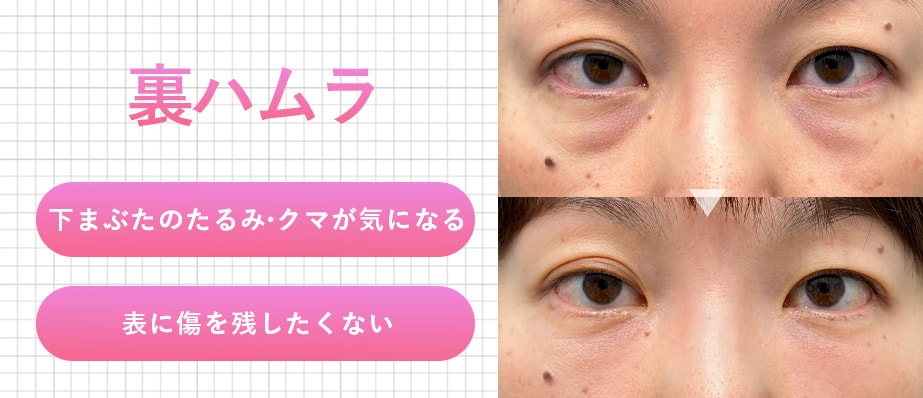 裏ハムラ