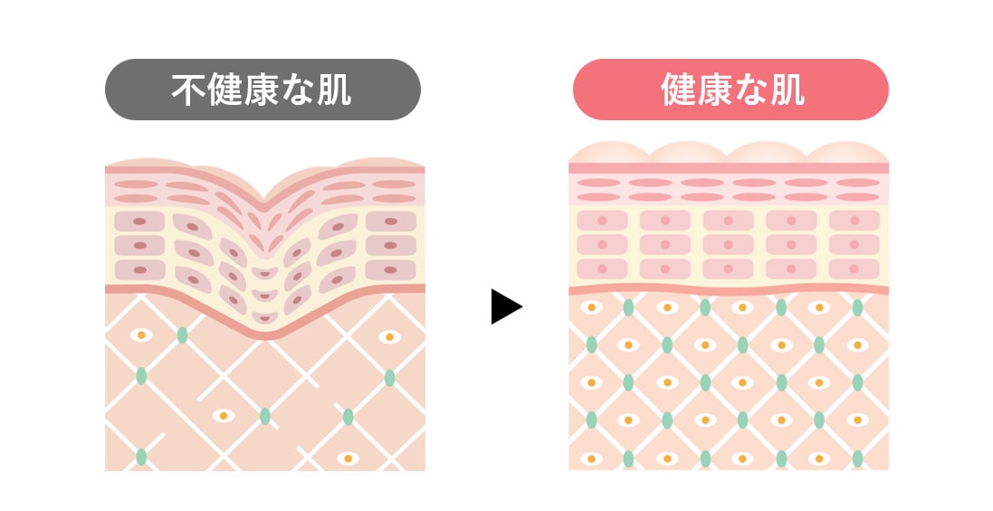 今注目されている理由<br />
