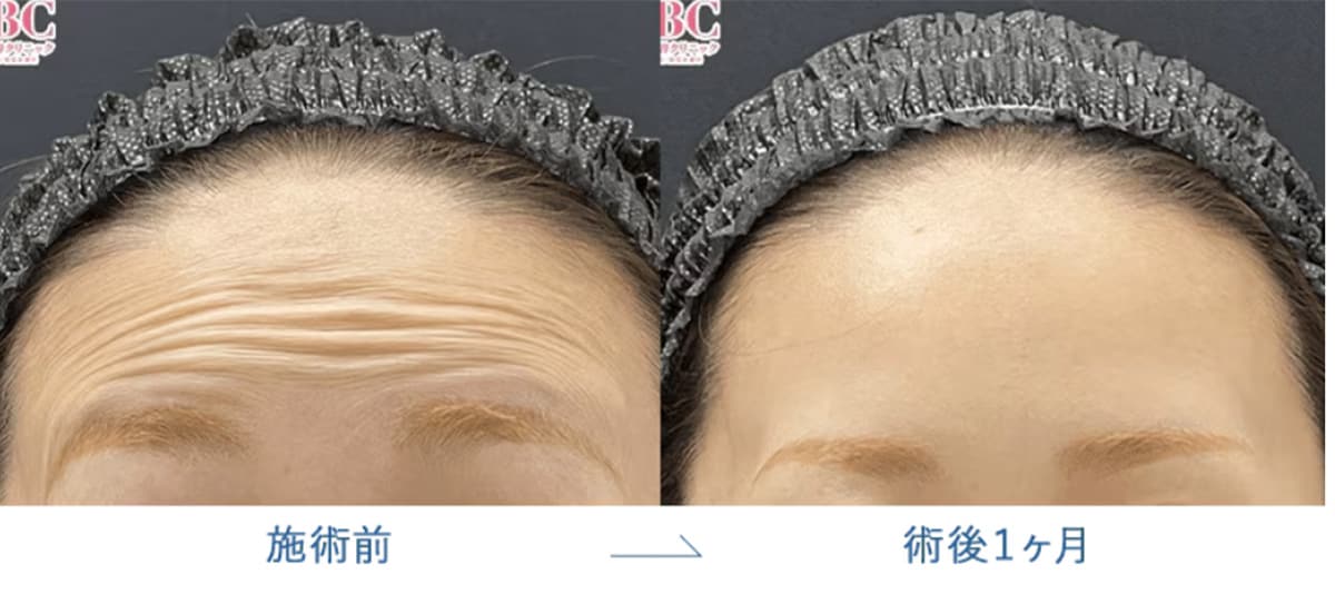 額