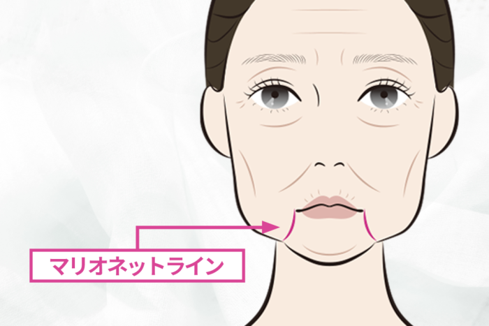 たるみを見分けるのは○○を見る！
