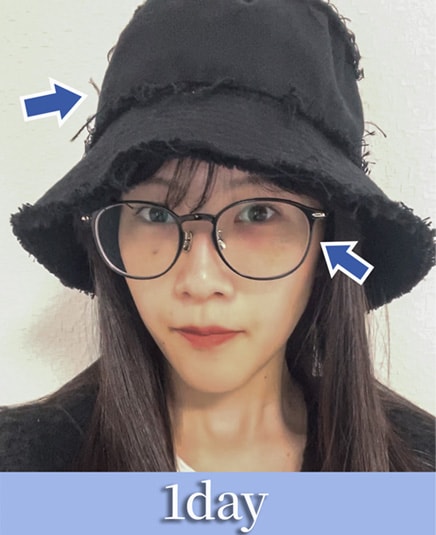 ダウンタイムを隠す工夫は？