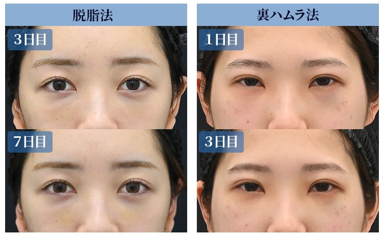 症状② 腫れ・むくみ