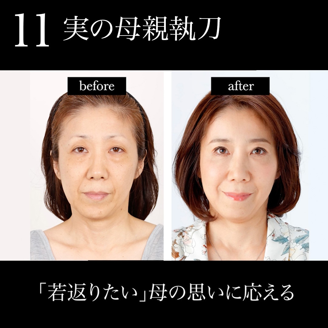 11.実の母親を執刀