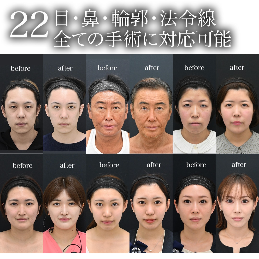 22.目・鼻・輪郭・法令線、全ての手術に対応可能<br />
