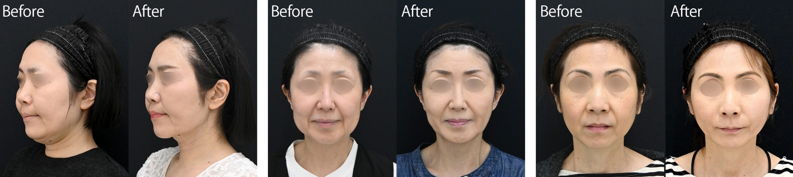 “50代