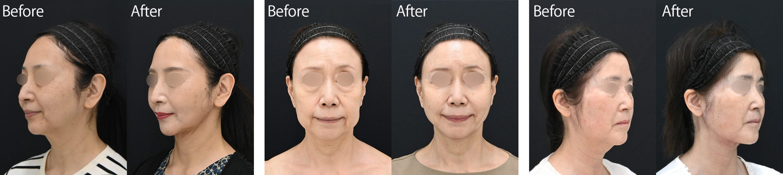 “60代