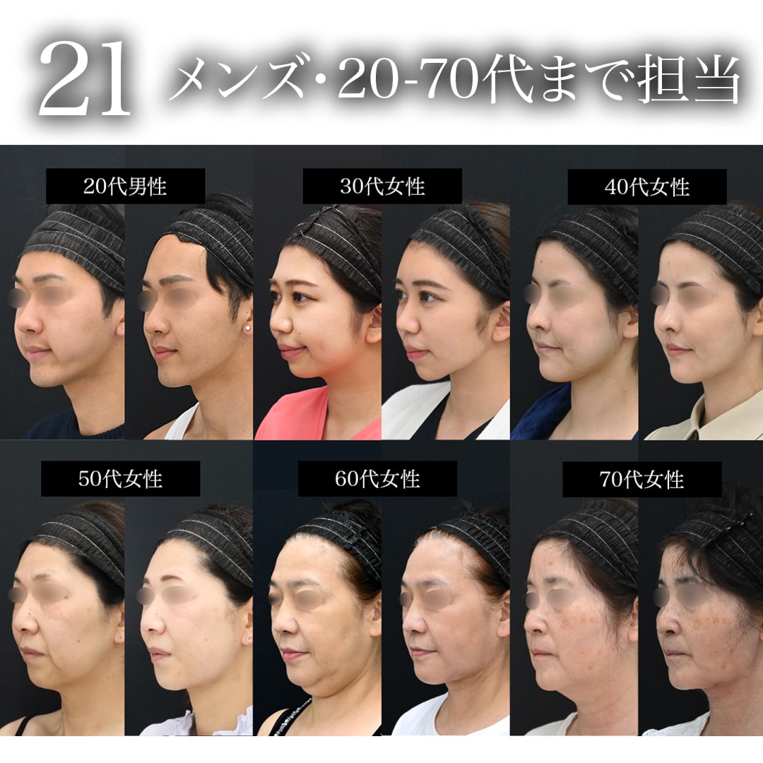 “21”