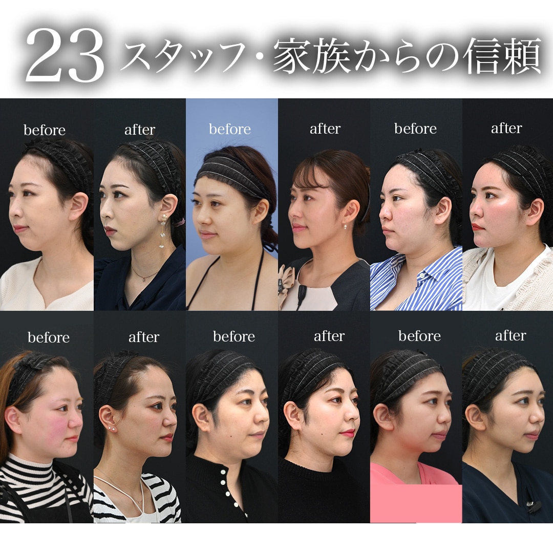 “23”