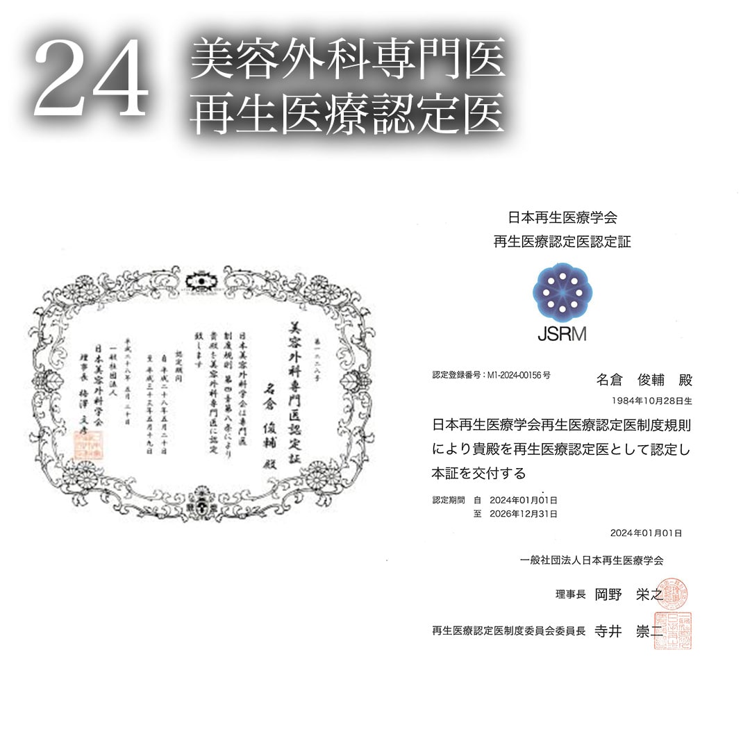 “24”