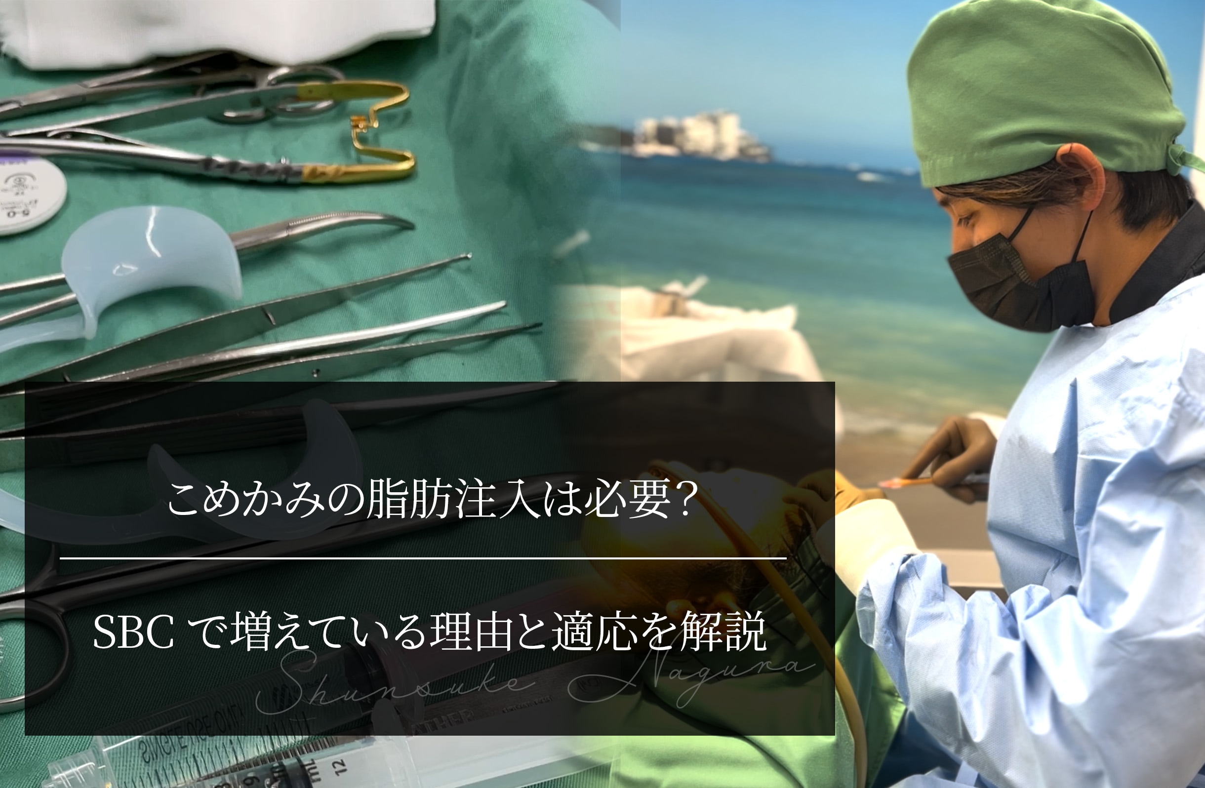 こめかみの脂肪注入って必要？ やるべき人・やらなくていい人の違い
