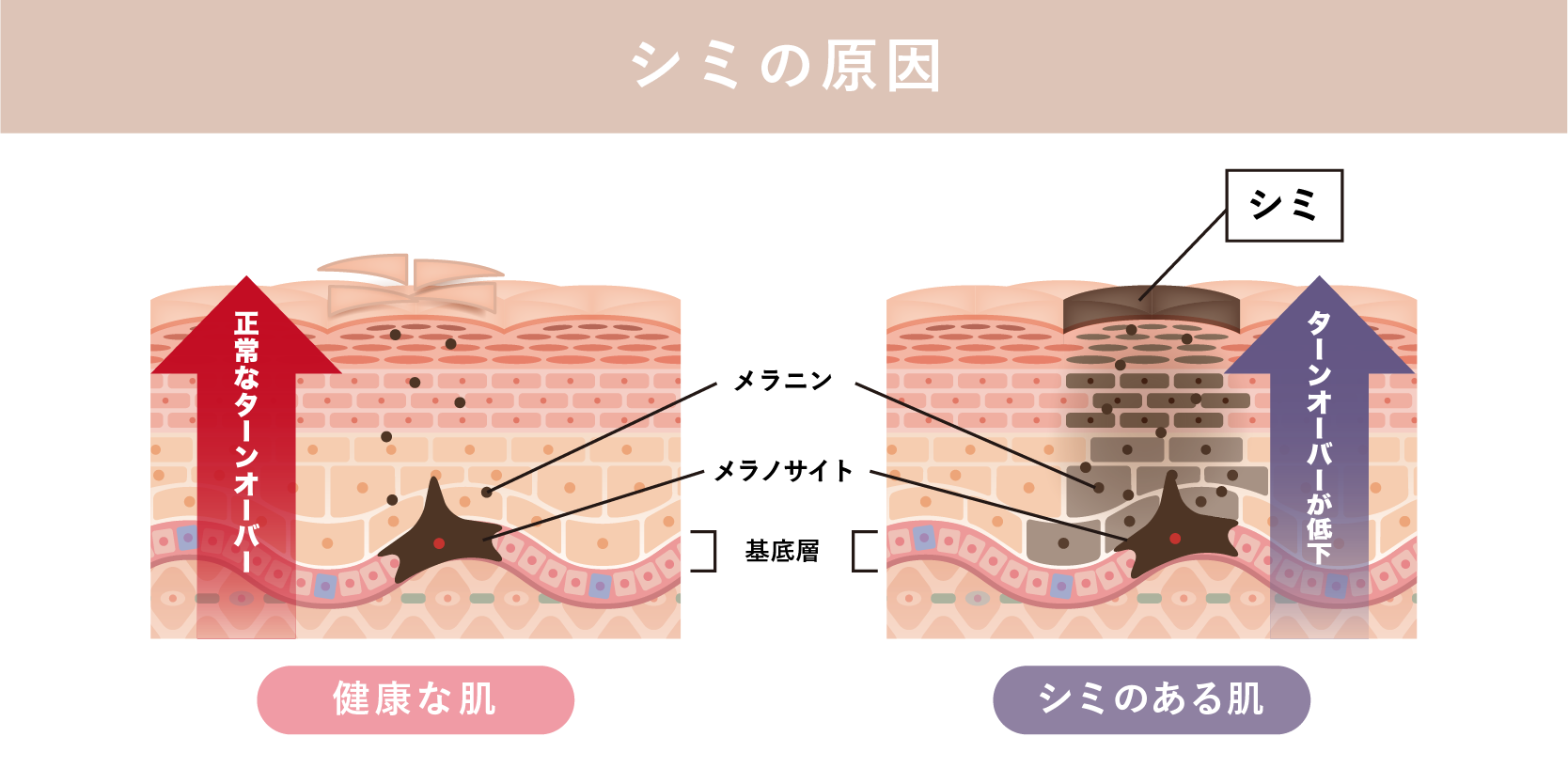 シミの原因は全てメラニン(色味)の蓄積