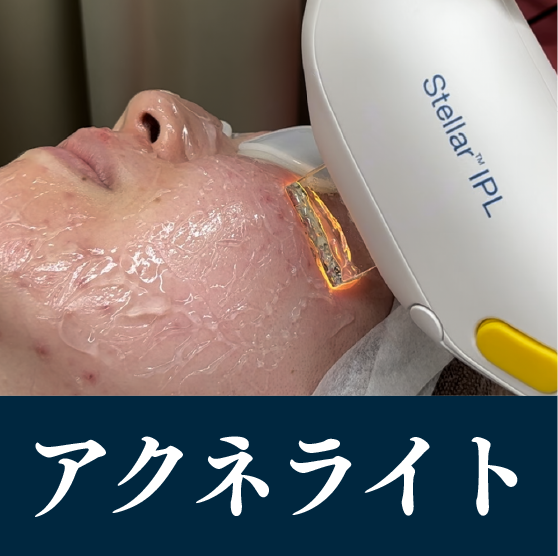 アクネライト